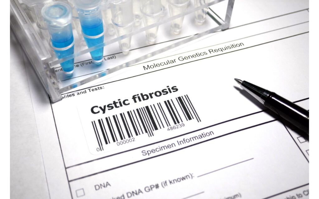 Amino Acid Supplementation: A Potential Aid for Cystic Fibrosis