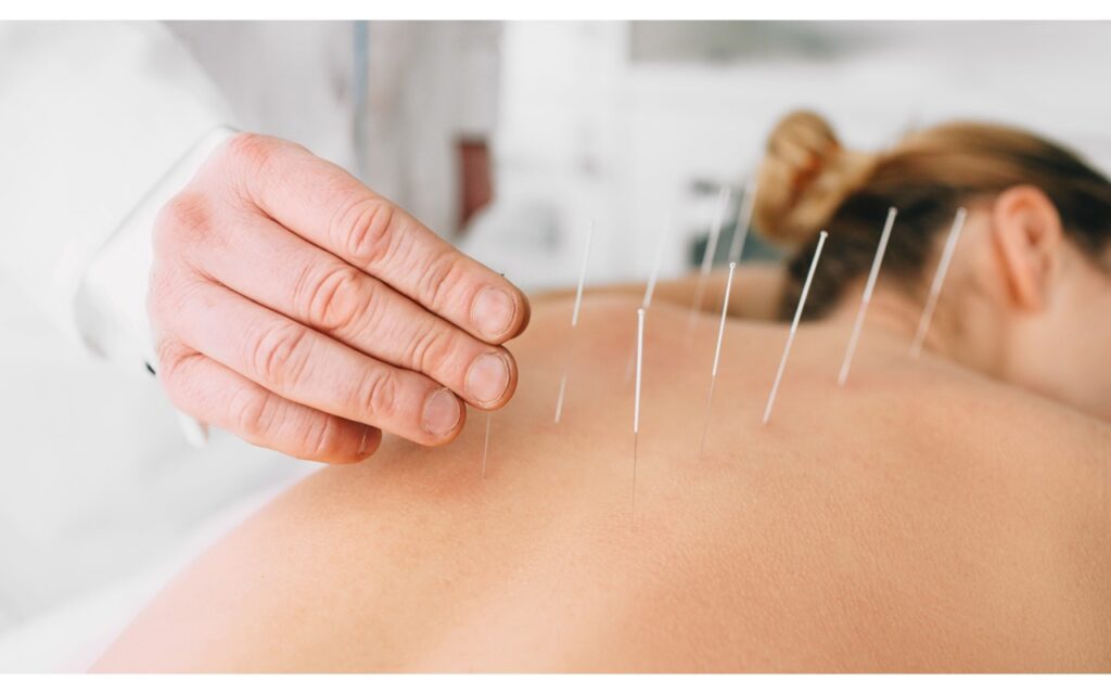 The Placebo Effect in Acupuncture for Chronic Pain