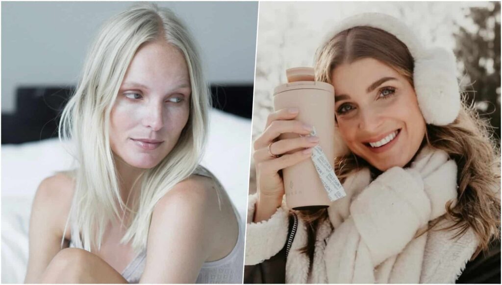 Natural Lift: The Powder That Targets Wrinkles, Dark Spots, and Cellulite — A Must-Try