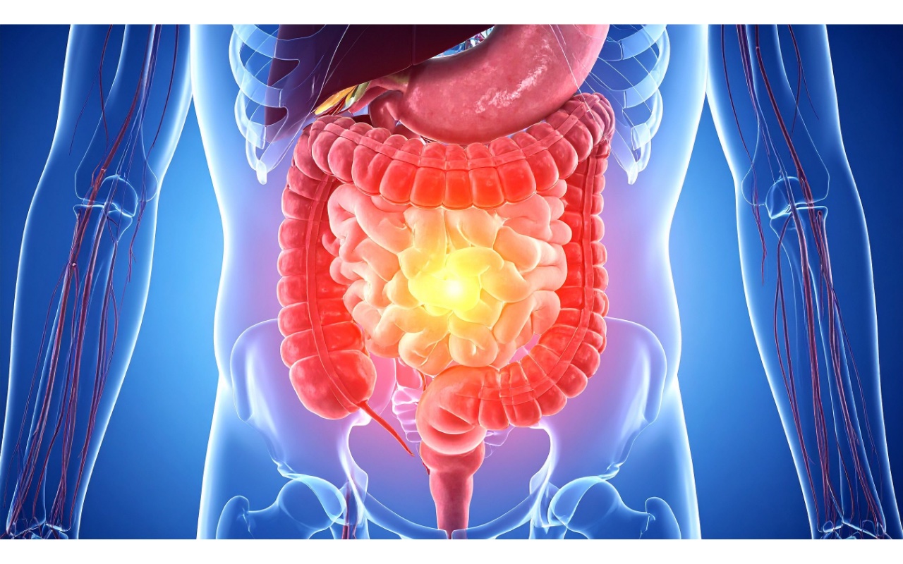 Leaky Gut: What Is Intestinal Permeability?