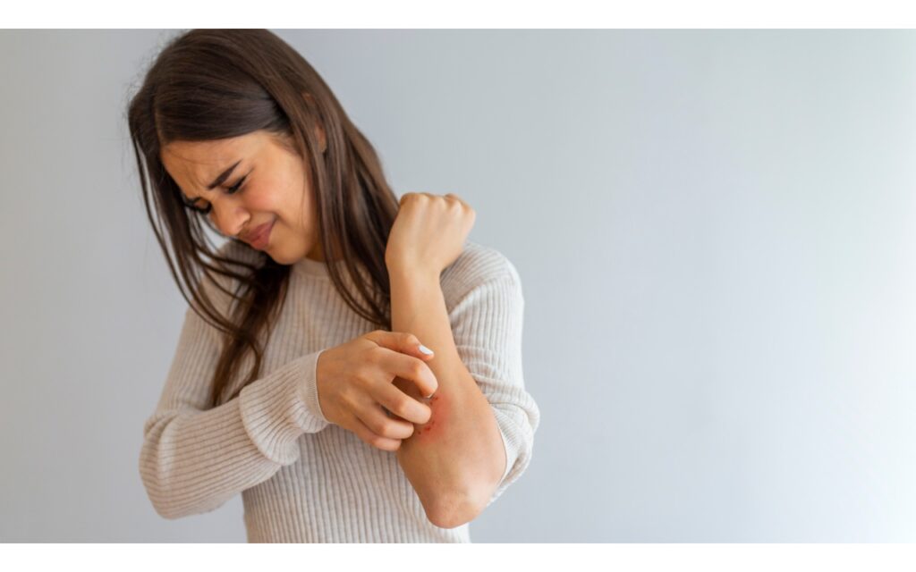 Psoriasis and Natural Remedies: What Science Says