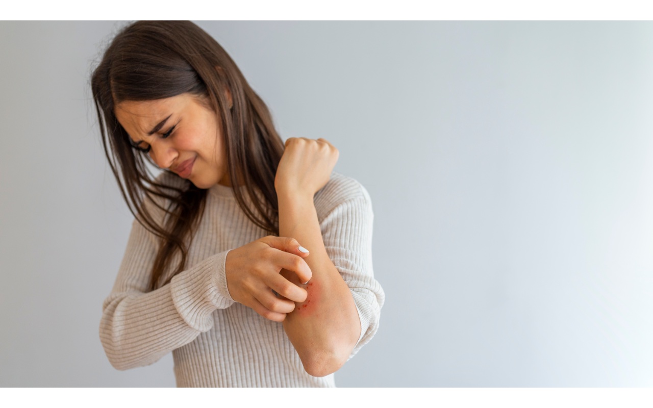 Psoriasis and Natural Remedies: What Science Says