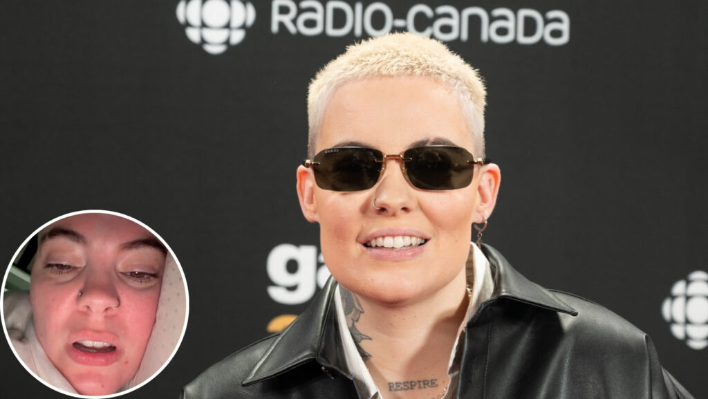 Big Punches to the Face: Roxane Bruneau Issues a Serious Warning