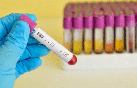 EBV: Human Monoclonal Antibodies That Block Entry into B Cells