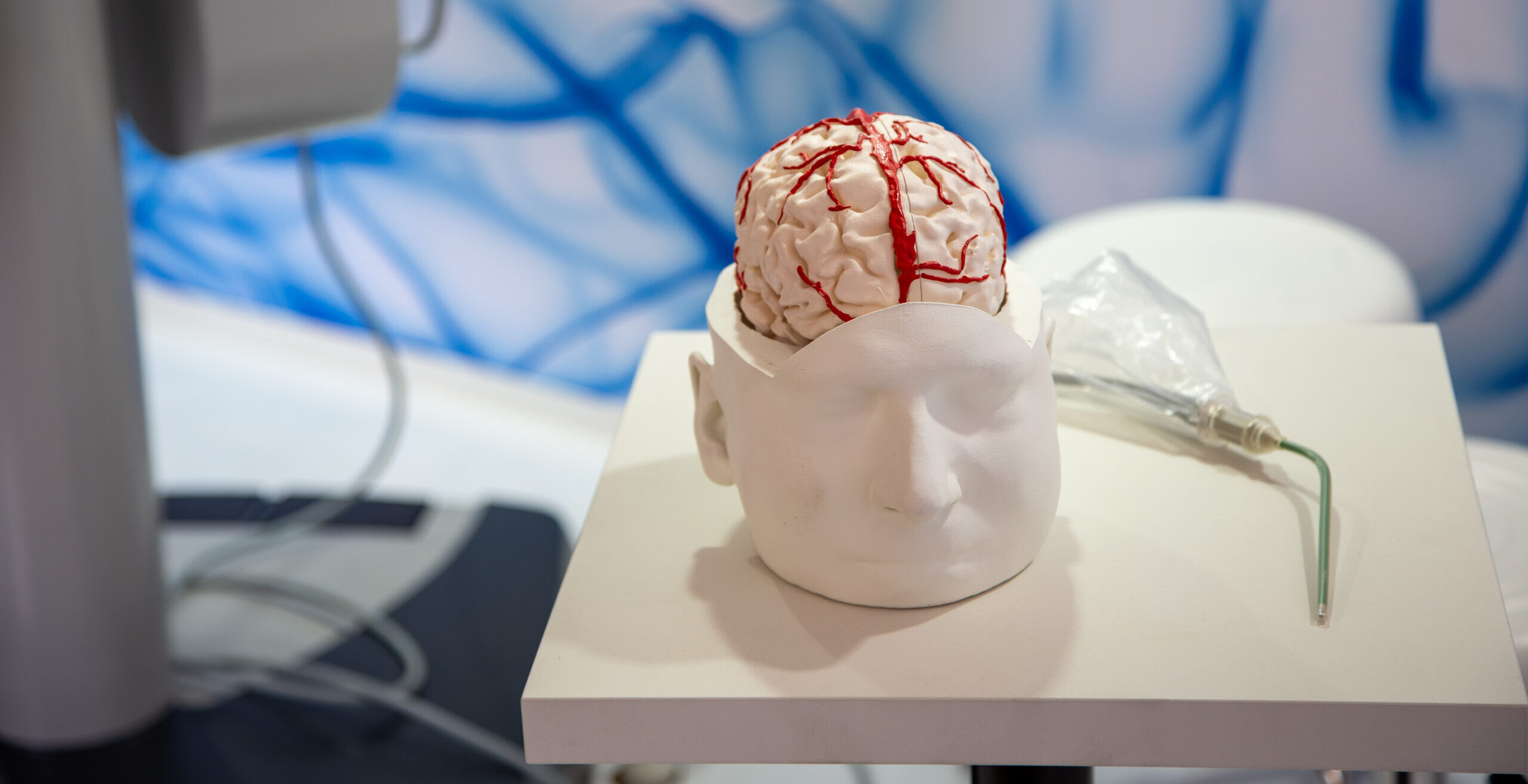 AI in Neurosurgery: New Applications Unveiled at the SINch Congress