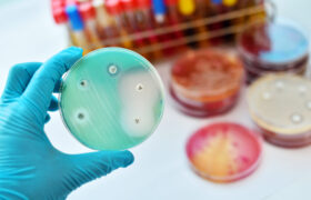 Antibiotic Resistance in Italy: AR-ISS Surveillance Data, Diagnosis, and Community-Based Therapies