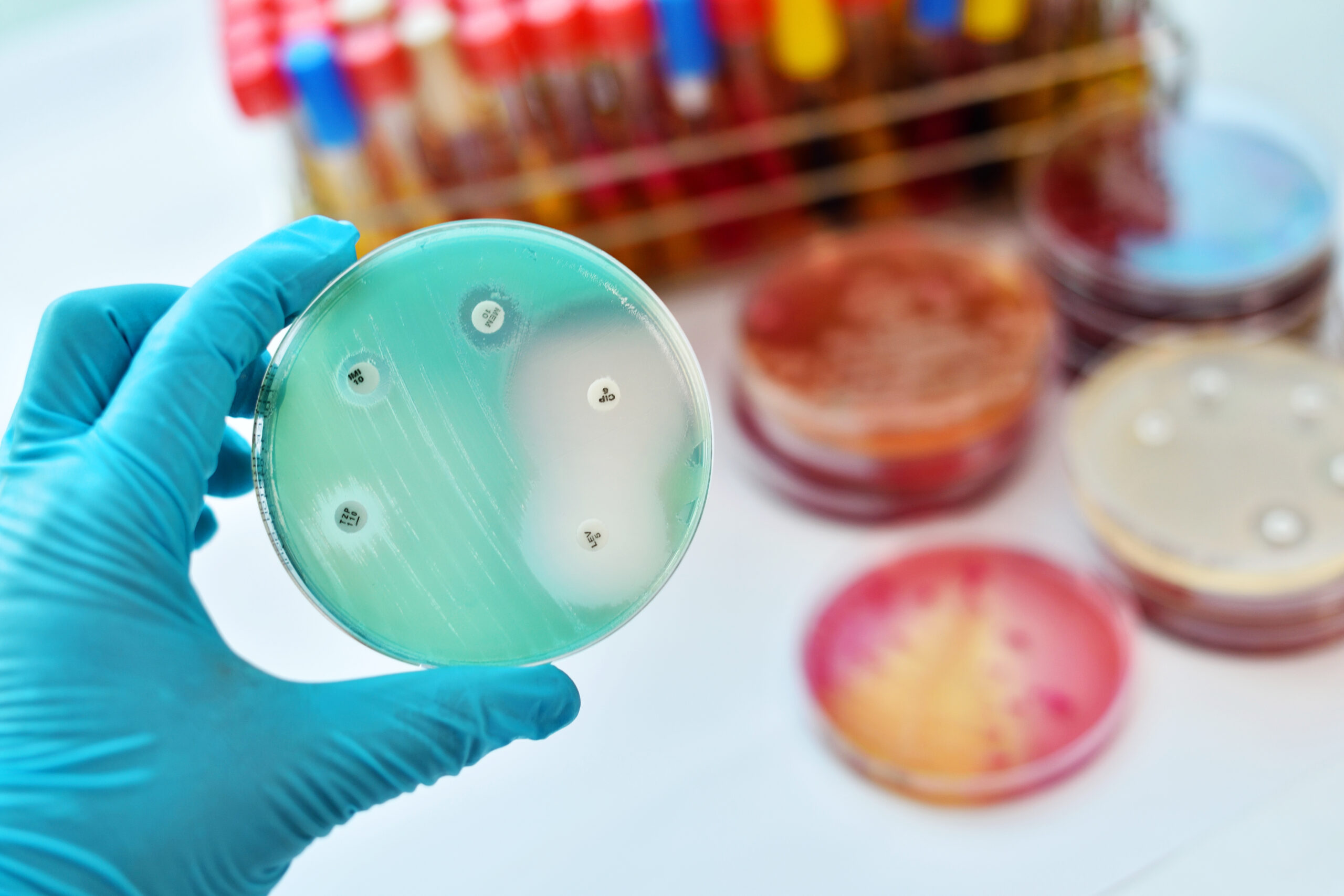 Antibiotic Resistance in Italy: AR-ISS Surveillance Data, Diagnosis, and Community-Based Therapies