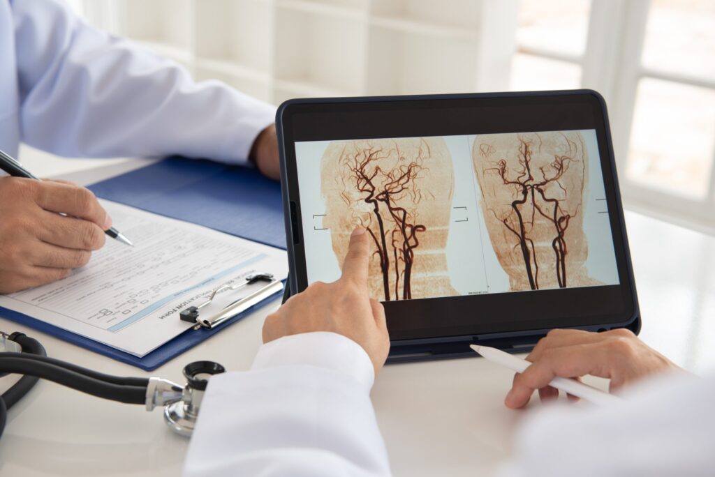 World Stroke Day: Prevention, Stroke Units, and Technologies